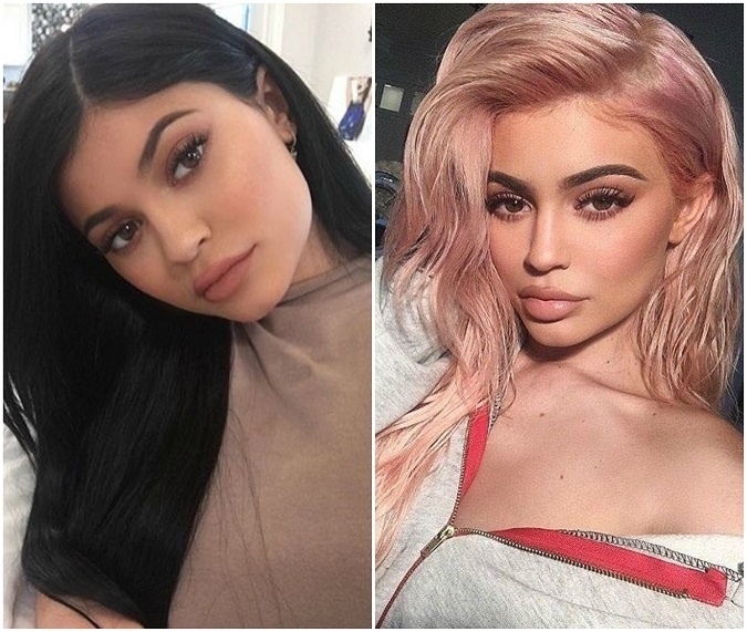 Najmladšia členka rodu Kardashian-Jenner, Kylie, si na svojom zovňajšku potrpí rovnako ako jej sestry