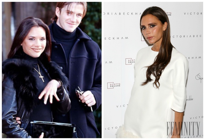 Victoria Beckham absolvovala niekoľko plastických a skrášľovacích operácií