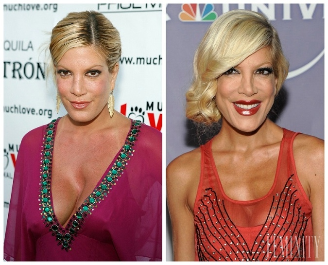 Herečka Tori Spelling pred, a po úprave nosa