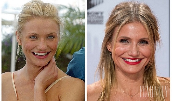 Ani celebrity nie sú podľa dnešného sveta dokonalé