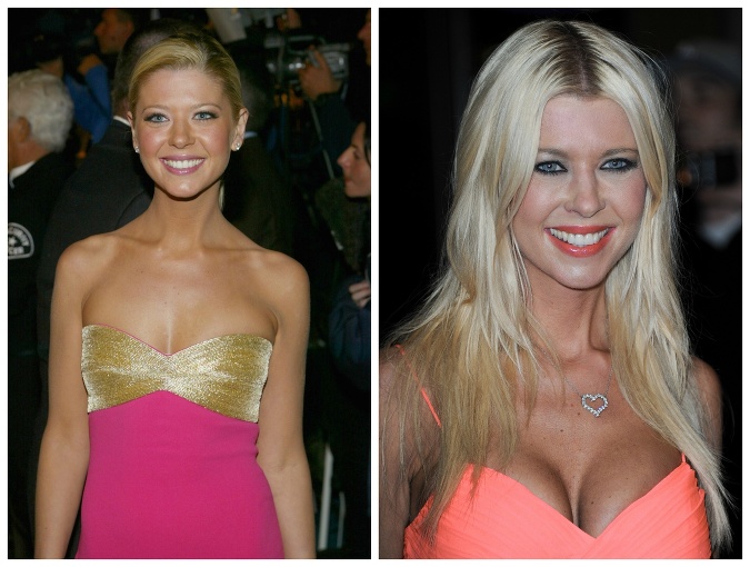 Tara Reid má za sebou veľké množstvo plastických operácií.