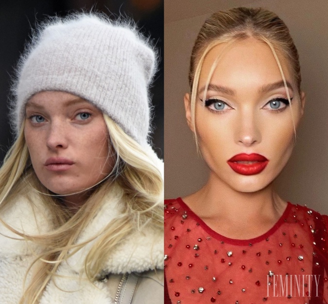 Aj modelka Elsa Hosk si ku krása rada dopomôže