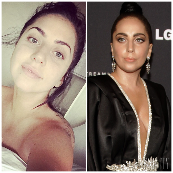 Lady Gaga je známa výstrednými lookmi, ale prirodzenosť je pristane viac