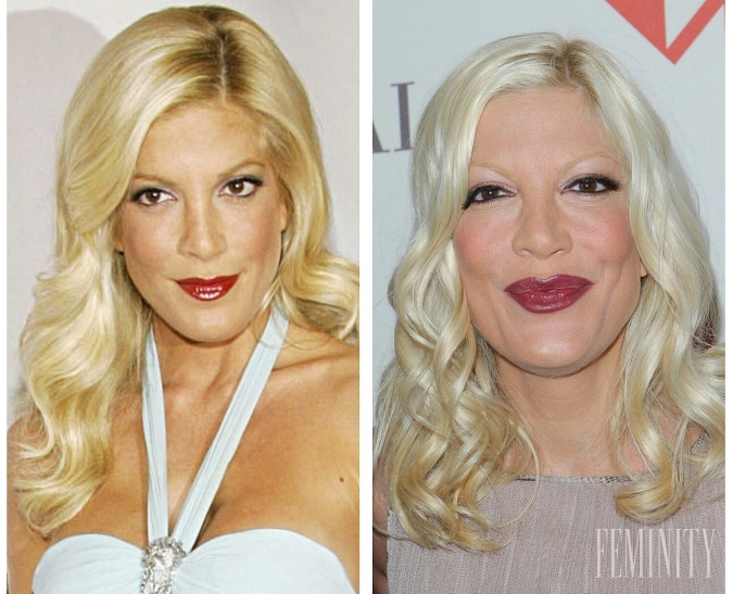 Tori Spelling je rovnakým prípadom, ako jej predchádzajúce kolegyne