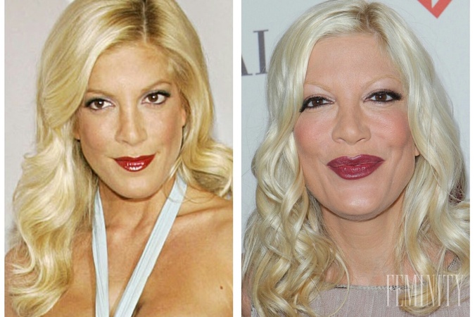 Tori Spelling je rovnakým prípadom, ako jej predchádzajúce kolegyne