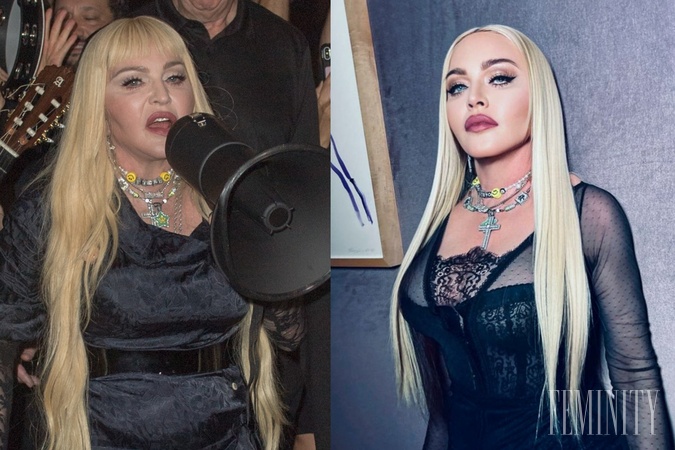 Madonna to v poslednej dobe s filtrami viditeľne preháňa