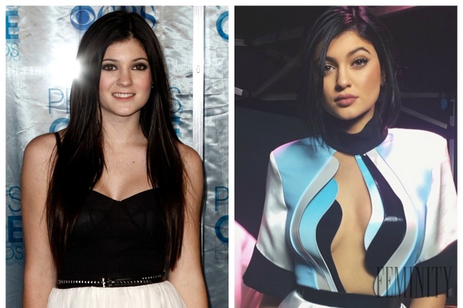 Kylie Jenner prešla naozaj výraznou premenou!