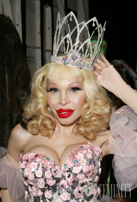 Kráľovnou v úprave pier, ale aj všetkého je rozhodne transexuál Amanda Lepore