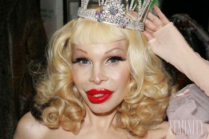 Kráľovnou v úprave pier, ale aj všetkého je rozhodne transexuál Amanda Lepore