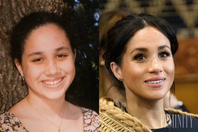 Pomohli Meghan Markle k dokonalej vizáži ruky plastickýh chirurgvov?