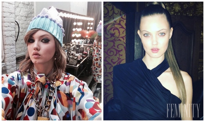 Lindsey Wixson má neobyčajné pery, ktoré zaujali mnohé módne domy