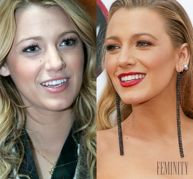 O krásnej herečke, Blake Lively, by snáď nikto nepochyboval, že je prirodzená, ale zdanie možno klame 